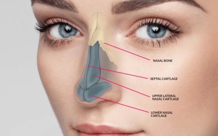 Understanding the Risks of the Rhinoplasty in Dubai