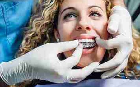 Forward-Thinking Smile Alignment You Can Trust in Gillingham