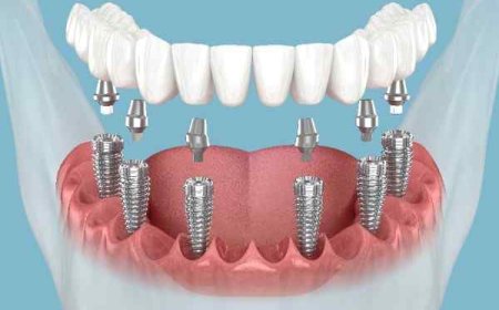 Smile Support That Matches Your Lifestyle in Stockport