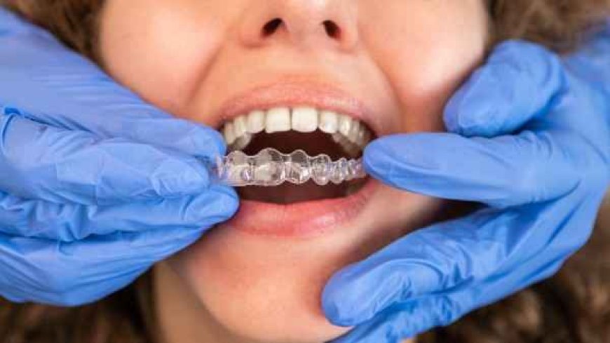 Planning a Coastal Trip with Aligners? Keep This in Mind