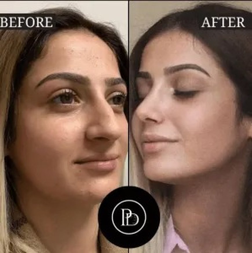 Best Aesthetic Clinics in Dubai for Facial Rejuvenation