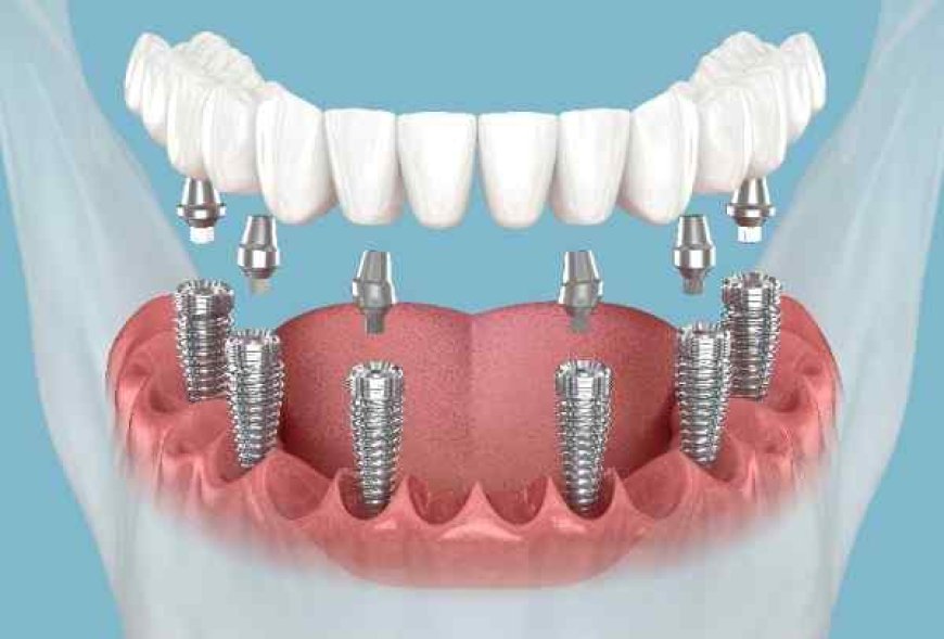 Smile Support That Matches Your Lifestyle in Stockport